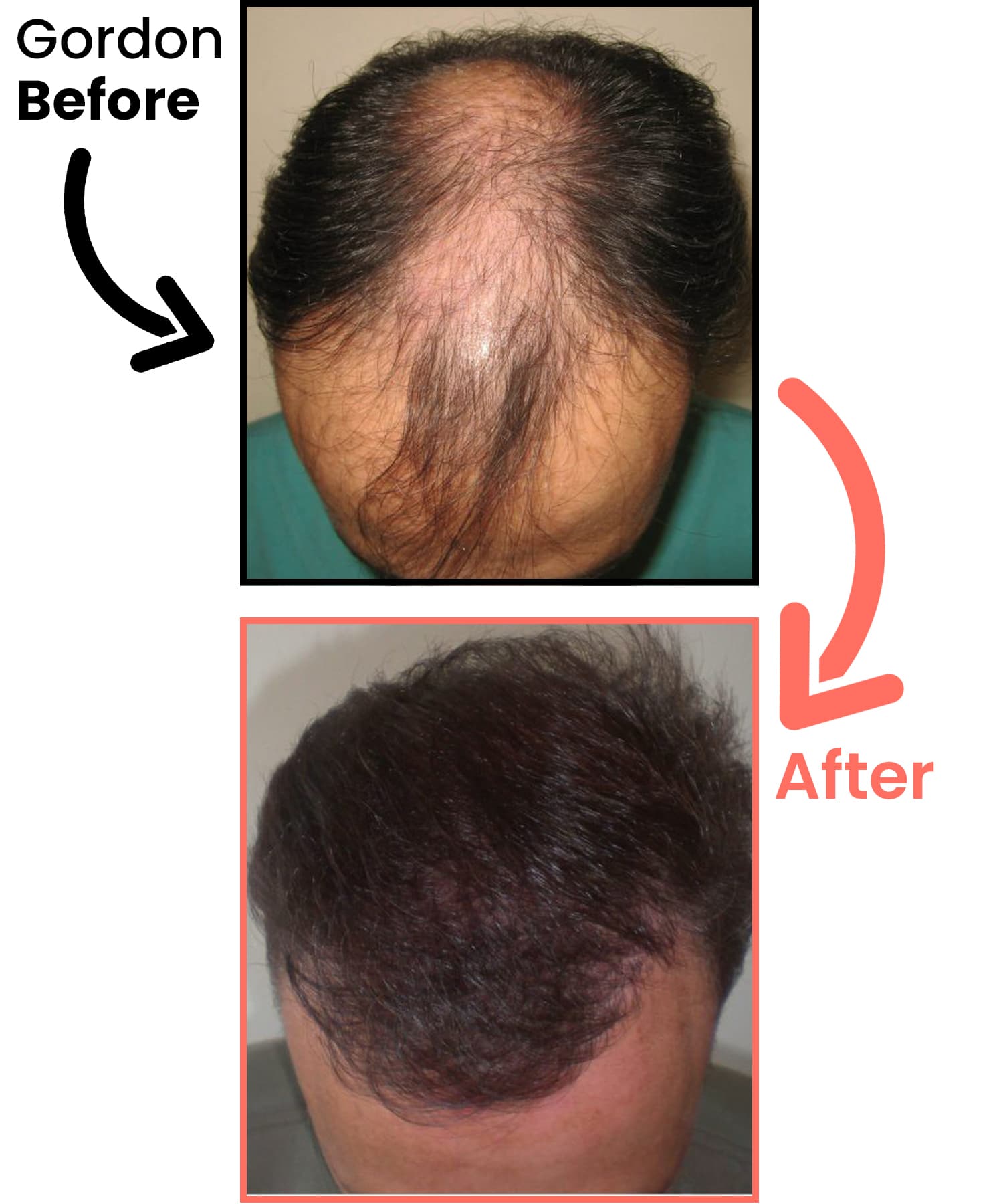 before-after-neu-gordon