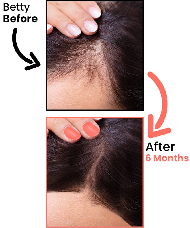 betty-before-after-6-months-heyrestore