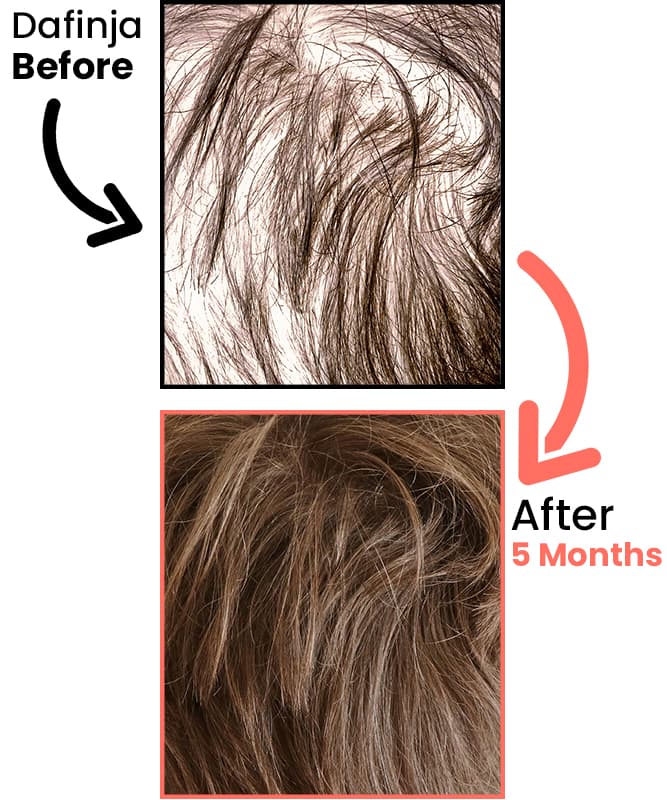 dafinja-before-after-5-months-heyrestore