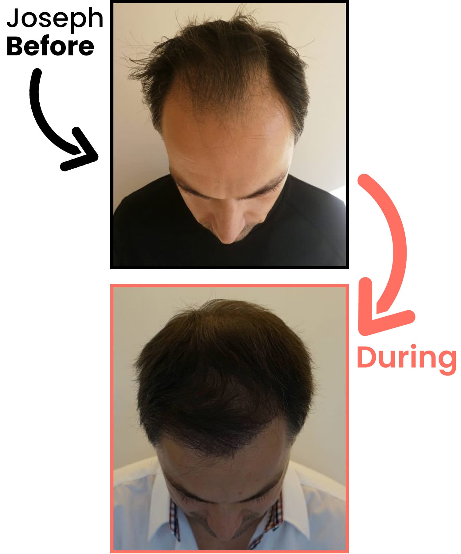 joseph-before-after-heyrestore