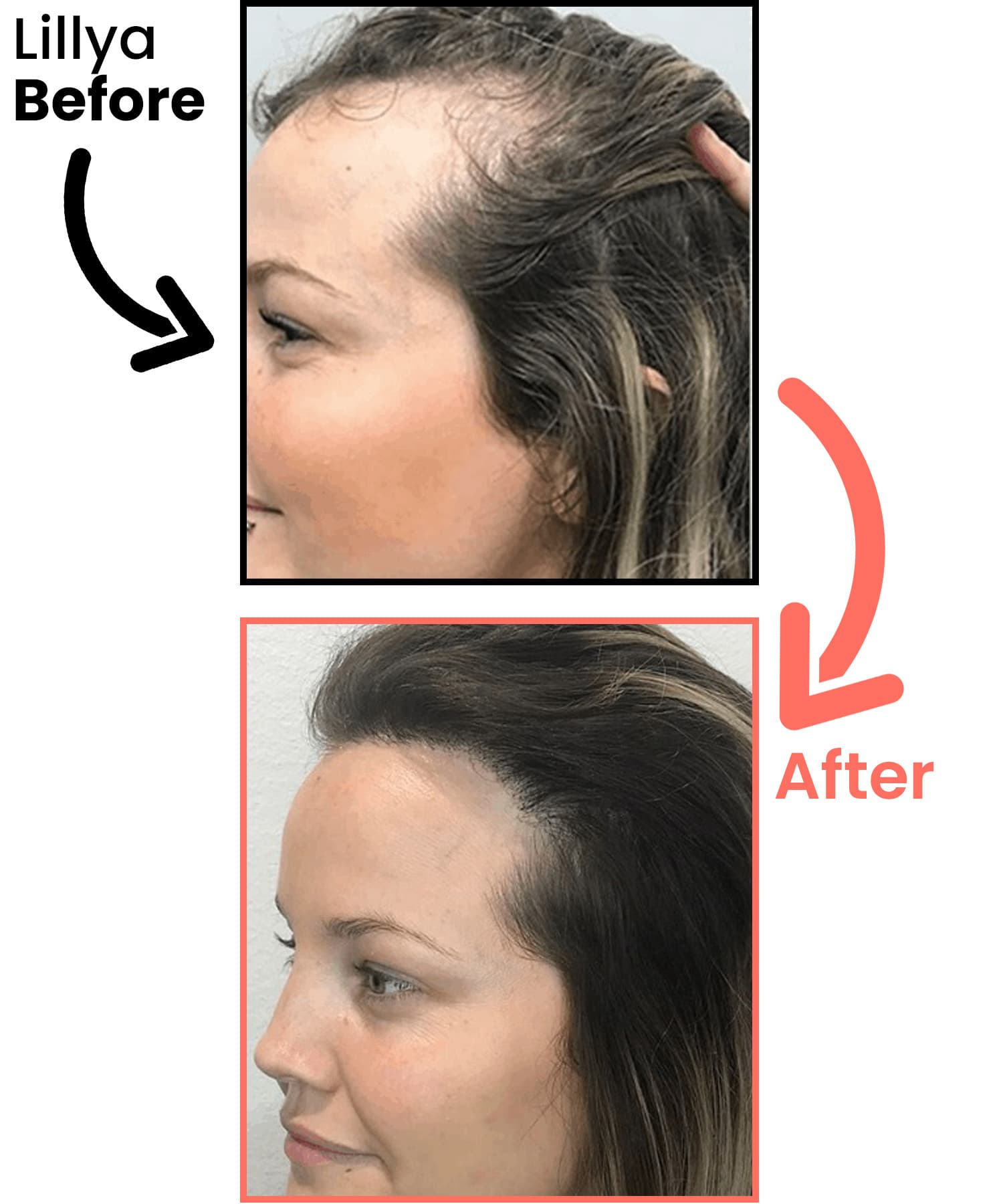 lillya-before-after-heyrestore