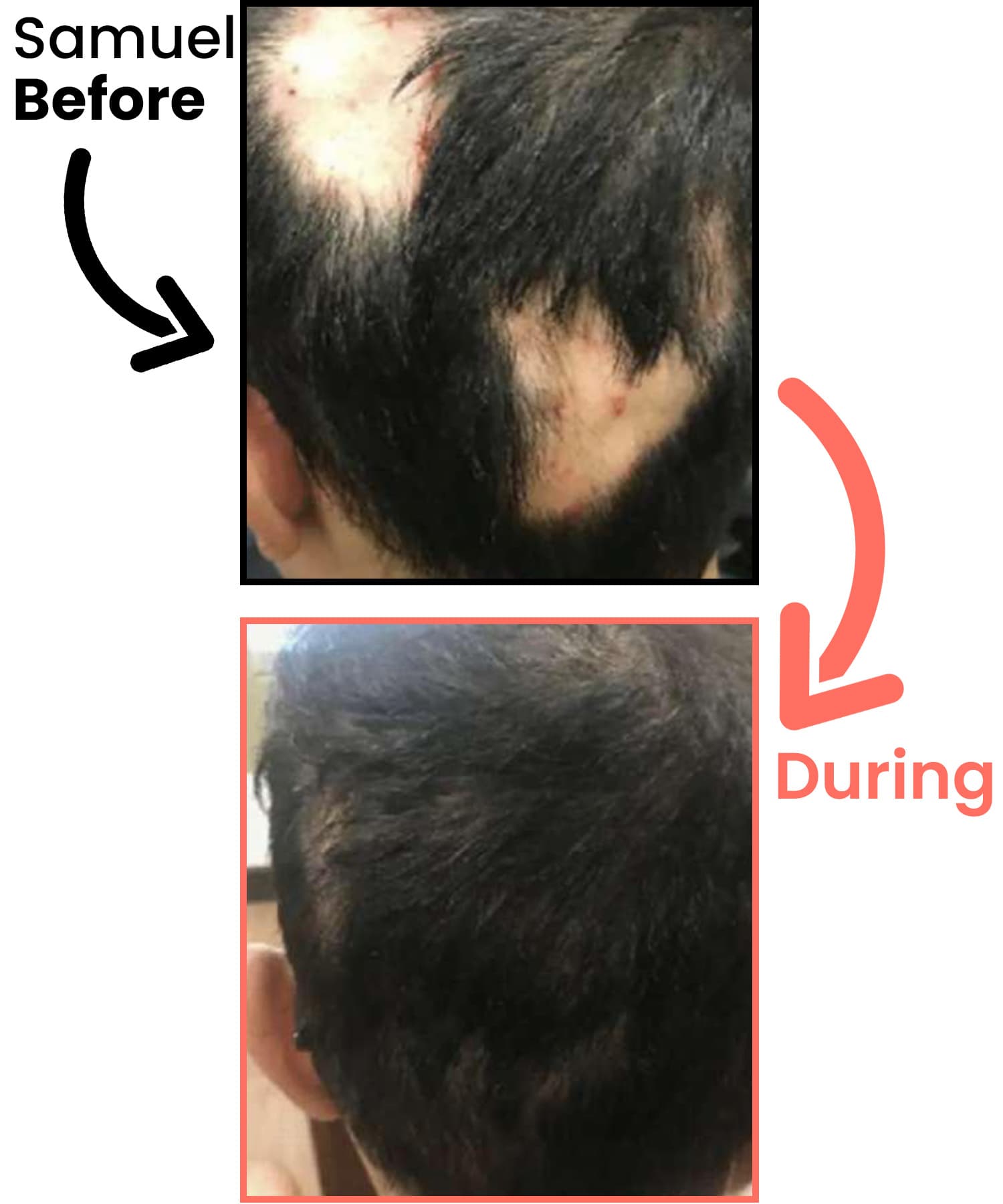 samuel-before-after-heyrestore