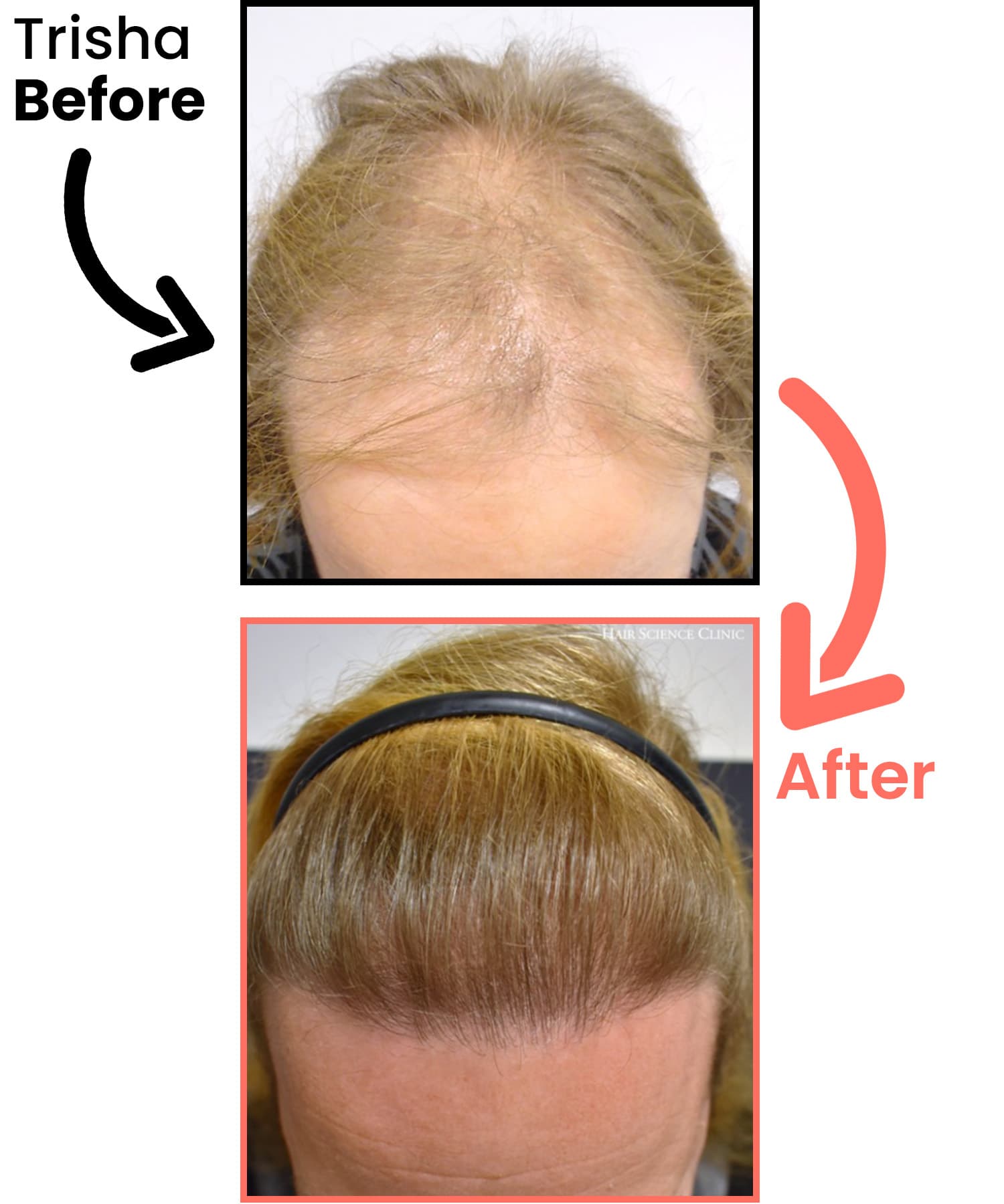 trisha-before-after-heyrestore