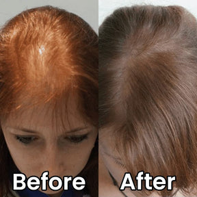 heyrestore-professional-hair-regrowth-laser-comb-back-to-full-and-strong-hair-before-after-women