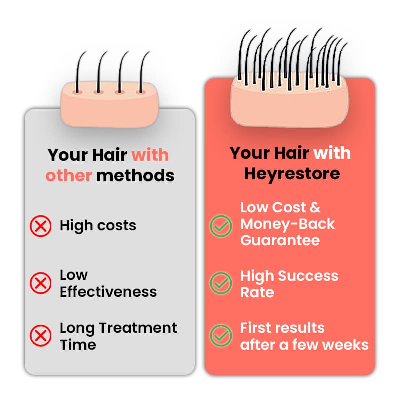 heyrestore-vs-other-hair-regrowth-methods