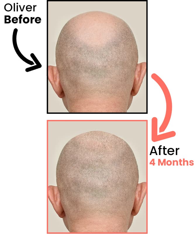oliver-before-after-4-months-heyrestore
